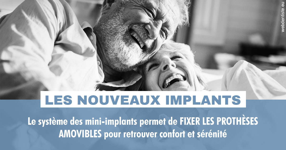 https://dr-blanchard-patrick-yves.chirurgiens-dentistes.fr/Les nouveaux implants 2