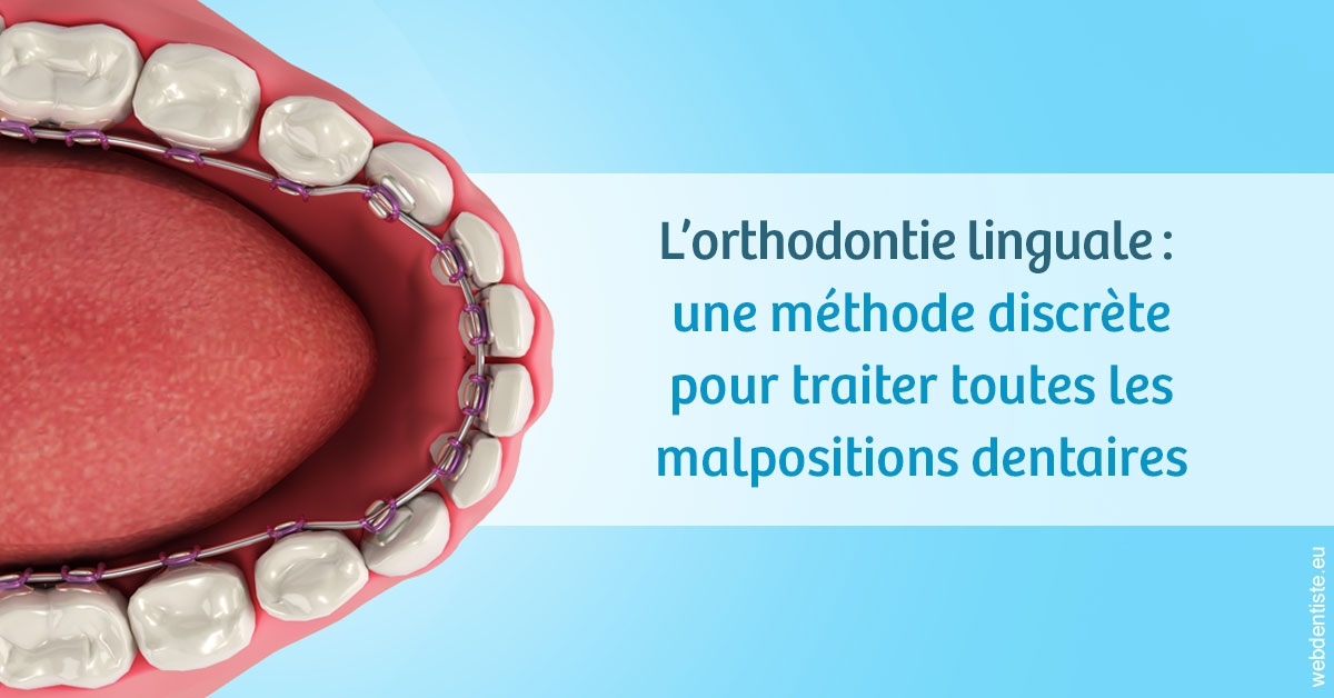 https://dr-blanchard-patrick-yves.chirurgiens-dentistes.fr/L'orthodontie linguale 1