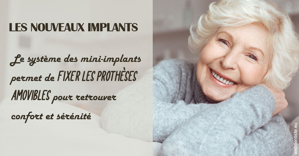 https://dr-blanchard-patrick-yves.chirurgiens-dentistes.fr/Les nouveaux implants 1