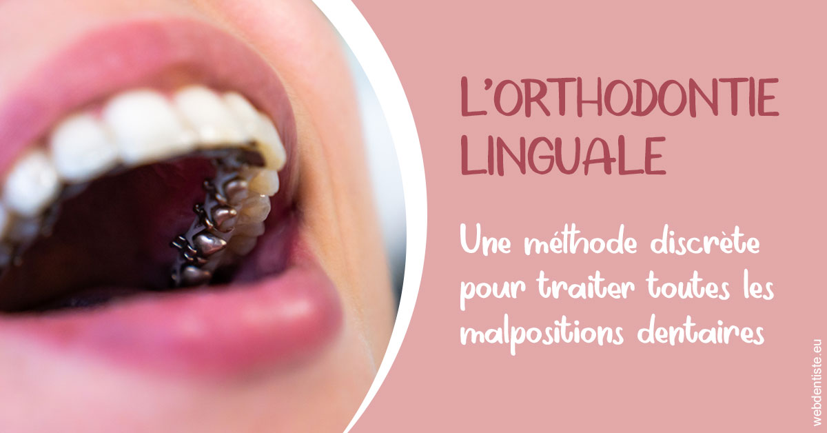 https://dr-blanchard-patrick-yves.chirurgiens-dentistes.fr/L'orthodontie linguale 2