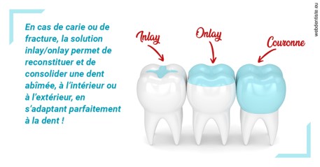 https://dr-blanchard-patrick-yves.chirurgiens-dentistes.fr/L'INLAY ou l'ONLAY