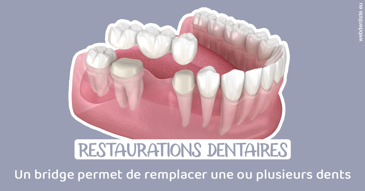 https://dr-blanchard-patrick-yves.chirurgiens-dentistes.fr/Bridge remplacer dents 1
