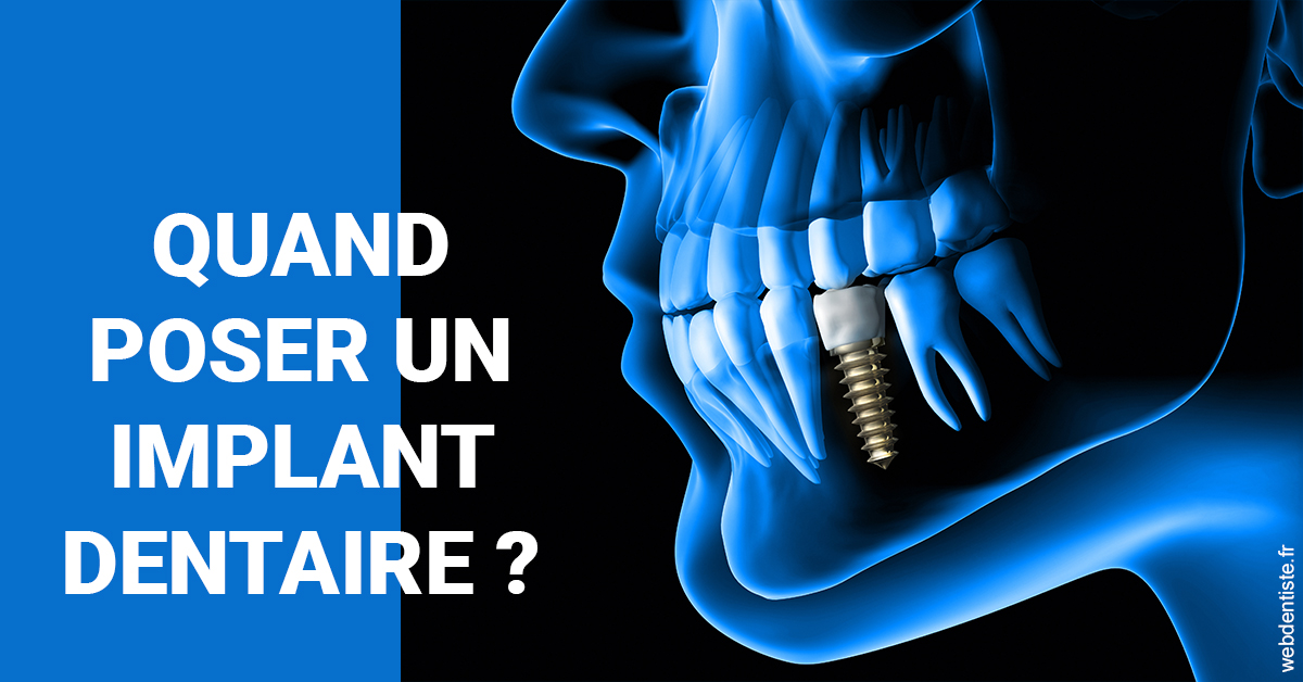 https://dr-blanchard-patrick-yves.chirurgiens-dentistes.fr/Les implants 1