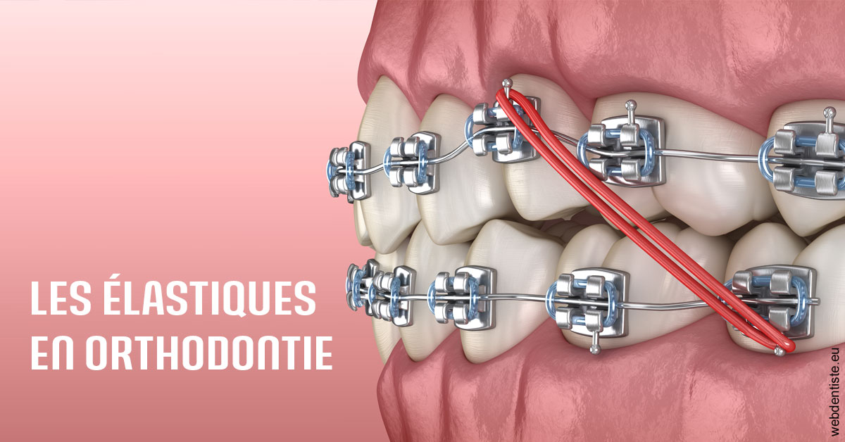 https://dr-blanchard-patrick-yves.chirurgiens-dentistes.fr/Elastiques orthodontie 2
