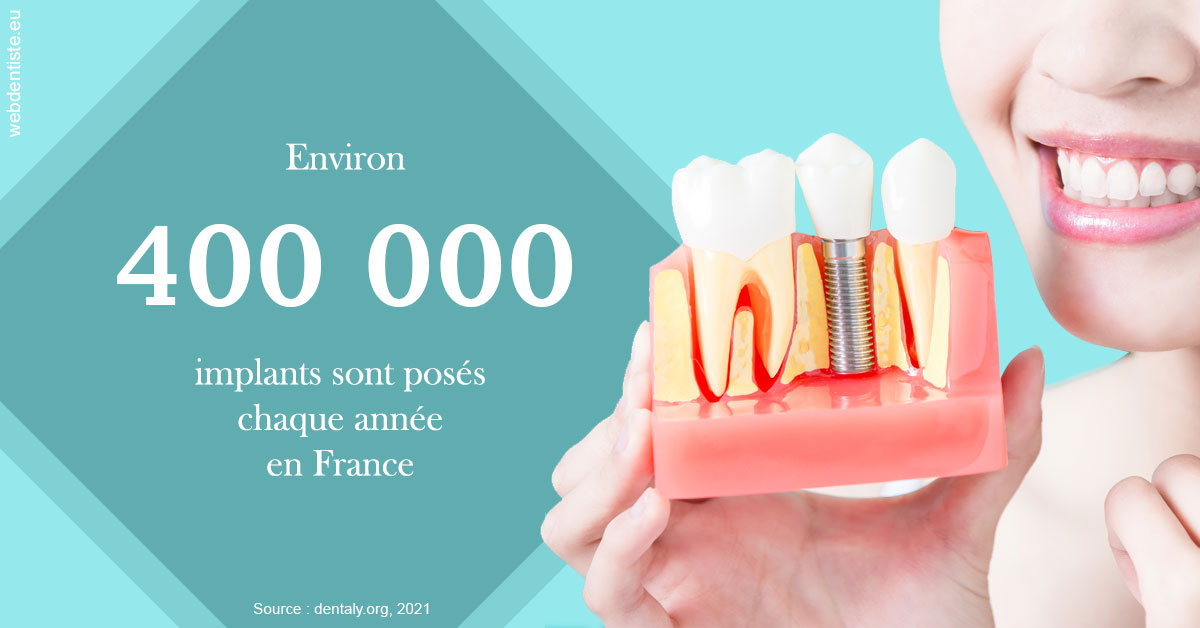 https://dr-blanchard-patrick-yves.chirurgiens-dentistes.fr/Pose d'implants en France 2