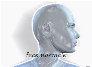 Variation du nez de face